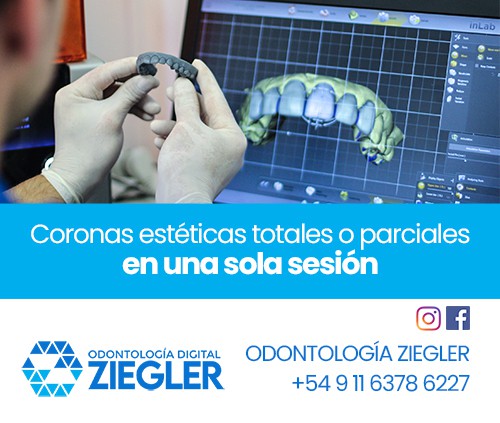 Ziegler Odontología Digital